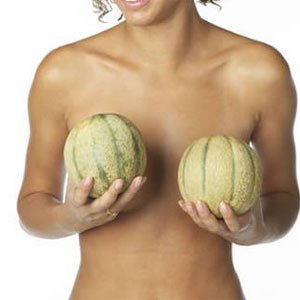 Asymmetrical breasts
